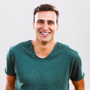 Braces timeline for adults